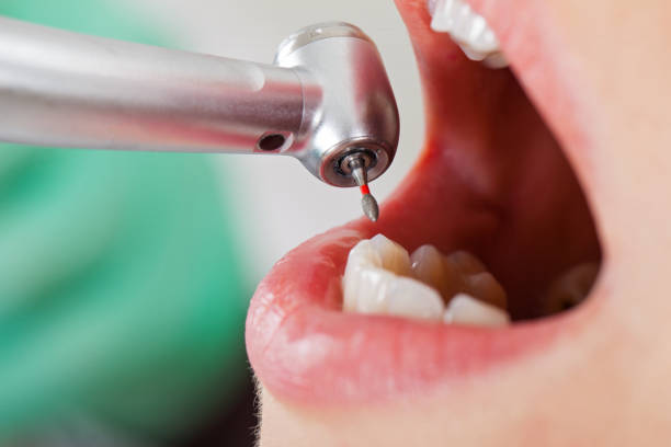 Best Same-Day Emergency Dental Services in Russell, KS
